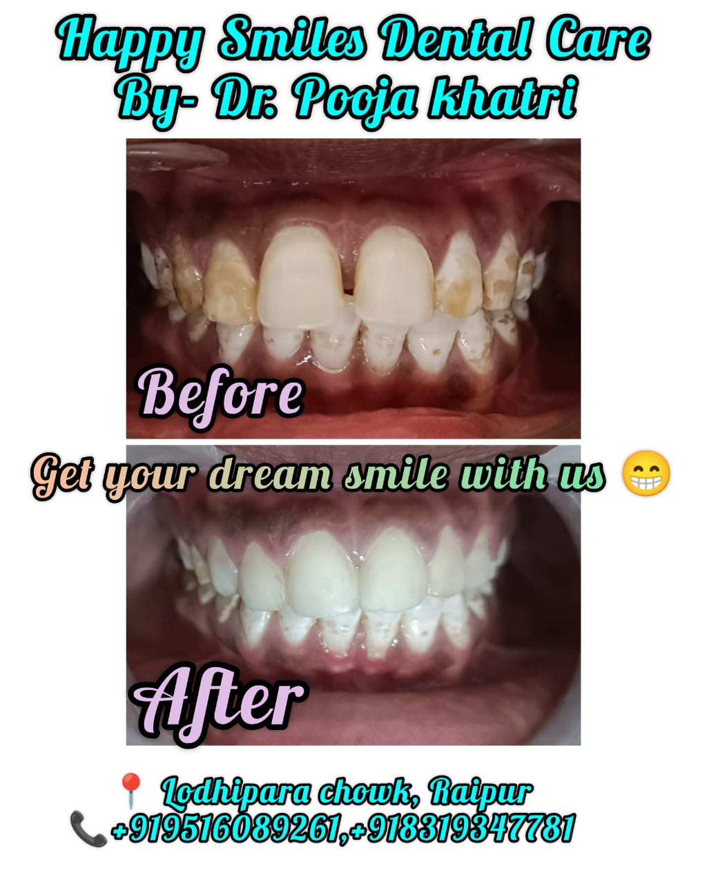 Before Treatment